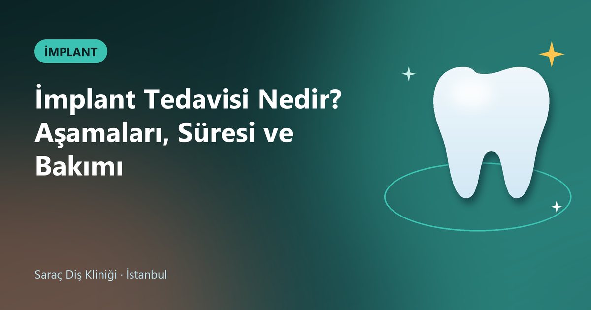 İmplant Tedavisi Nedir? Aşamaları, Süresi ve Bakımı – Saraç Diş blog kapak görseli